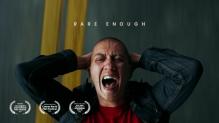 &quot;Rare Enough&quot; Documentary